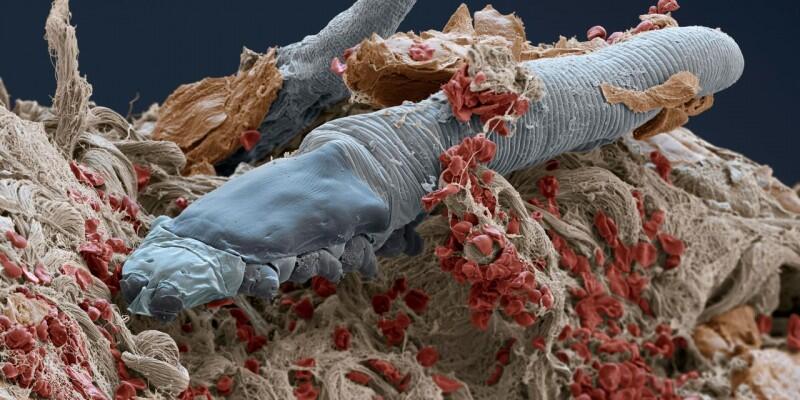 These microscopic mites live on your face