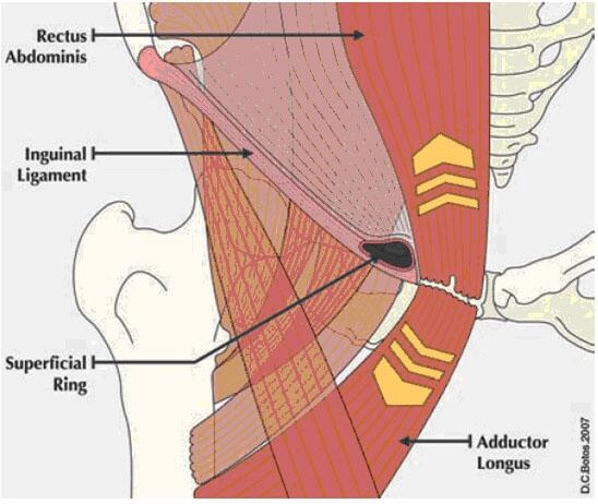 Less sports training tied to groin injury