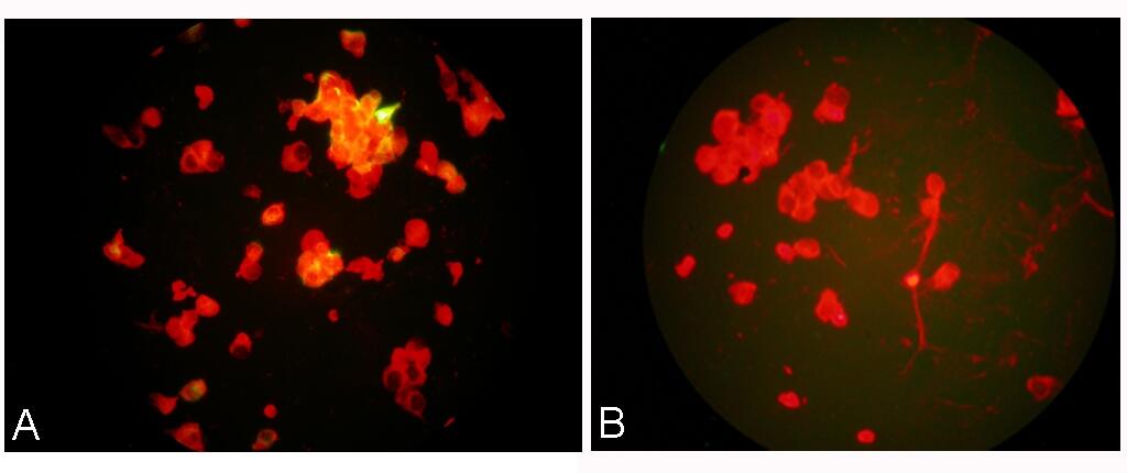 META PNEUMO VIRUS B: Un nouveau virus au Liban causé par le rhume