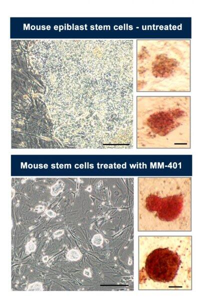 Drug makes stem cells become ’embryonic’ again