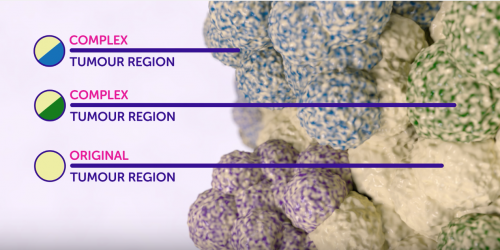 Tumor region