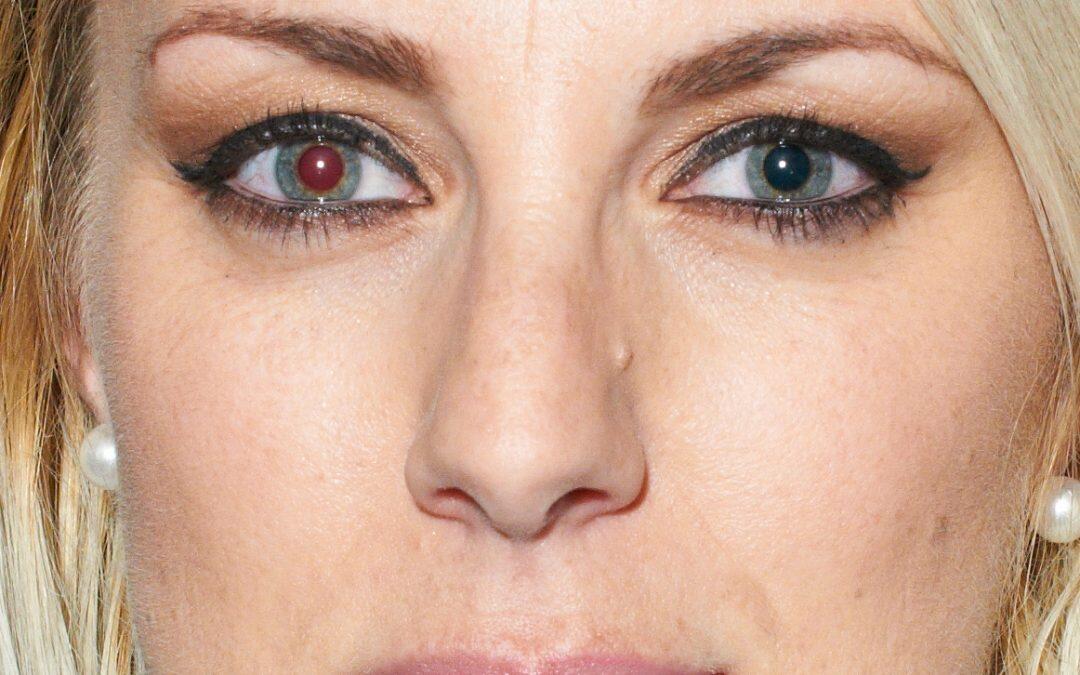 Pourquoi a-t-on les yeux rouges dans les photos et comment les éviter ?