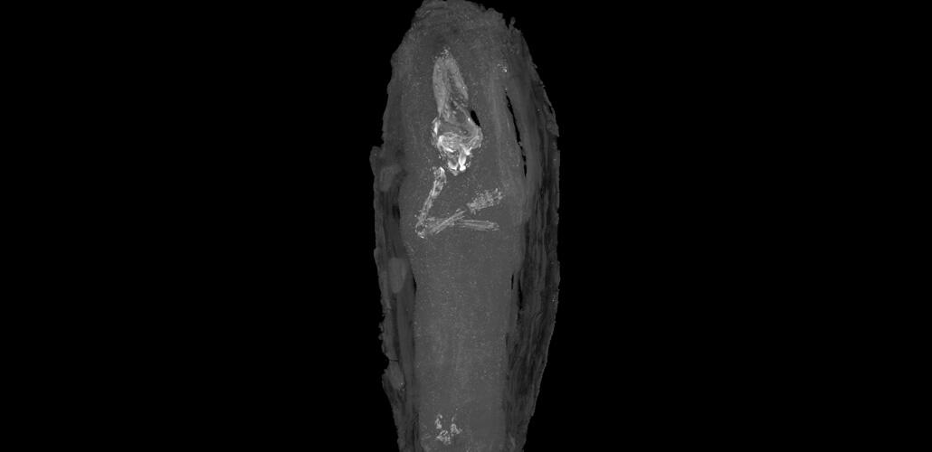 Newly Discovered Fetus In Egyptian Mummy