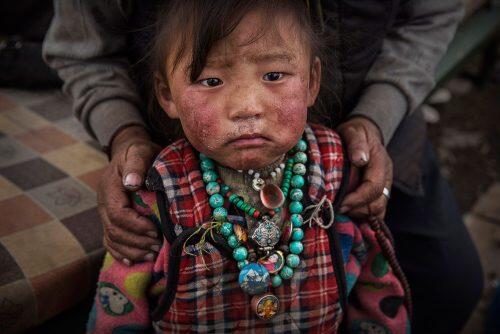 A young Tibetan child from a poor family sits in a tent at a temporary camp for cordycep pickers near ZadoiKevin Frayer/Getty Images