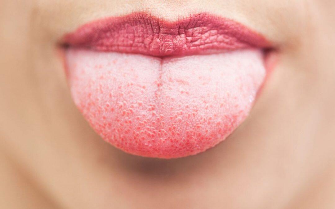 Did you know your tongue is the fastest healing part of your body