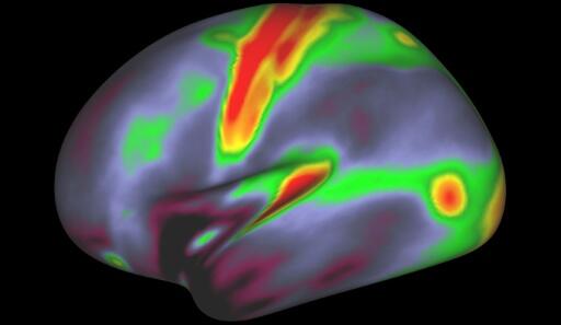 Des chercheurs dévoilent une carte du cerveau d’une précision inédite