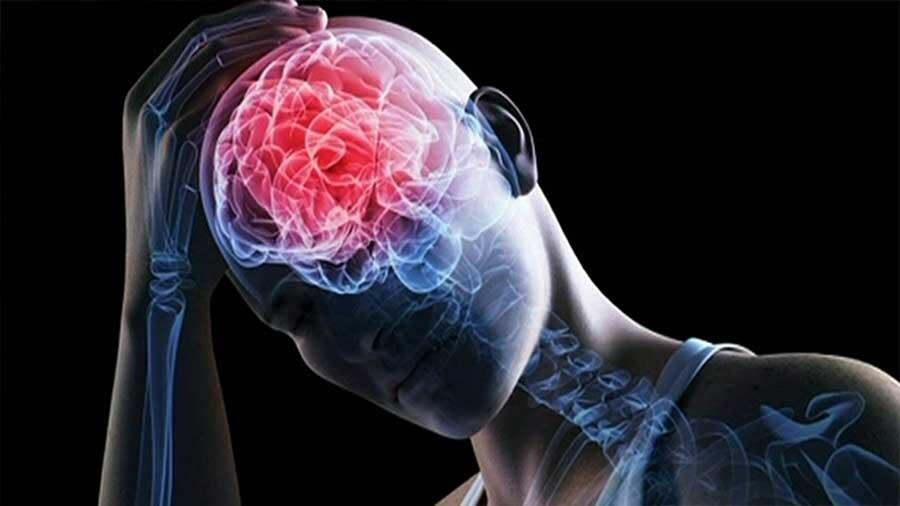 Las conmociones cerebrales no aumentan el riesgo de alzhéimer, pero sí de párkinson