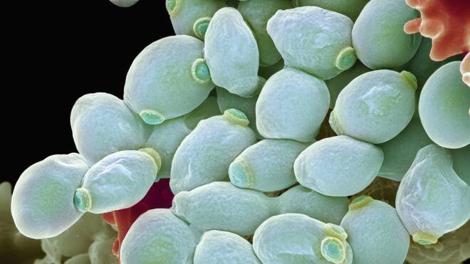 Fungal infection ‘threat’ to human health