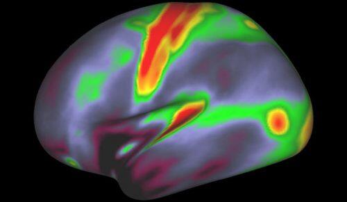 The pattern of brain activation (red, yellow) and deactivation (blue, green) in the left hemisphere when listening to stories while in the MRI scanner. (AFP/Nature) 