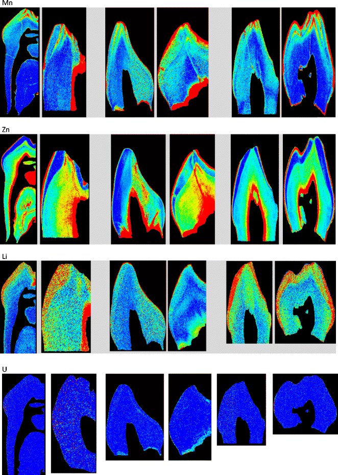 Lead (Pb), magnesium (Mg), chromium (Cr), manganese (Mn), zinc (Zn), lithium (Li), and uranium (U) in deciduous teeth of children from Iraq (high exposure to war pollutants), Lebanon (intermediate exposure to war pollutants), and Iran (low exposure to war pollutants) 