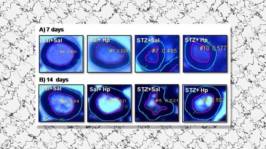 Un tratamiento experimental inhibe el dolor en animales con neuropatía diabética