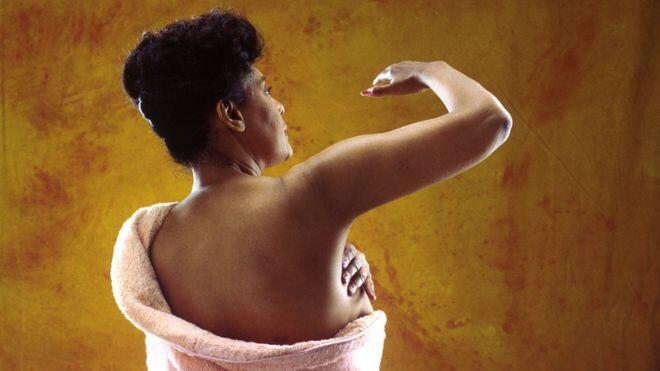 Breast cancer ‘more often advanced’ in black women