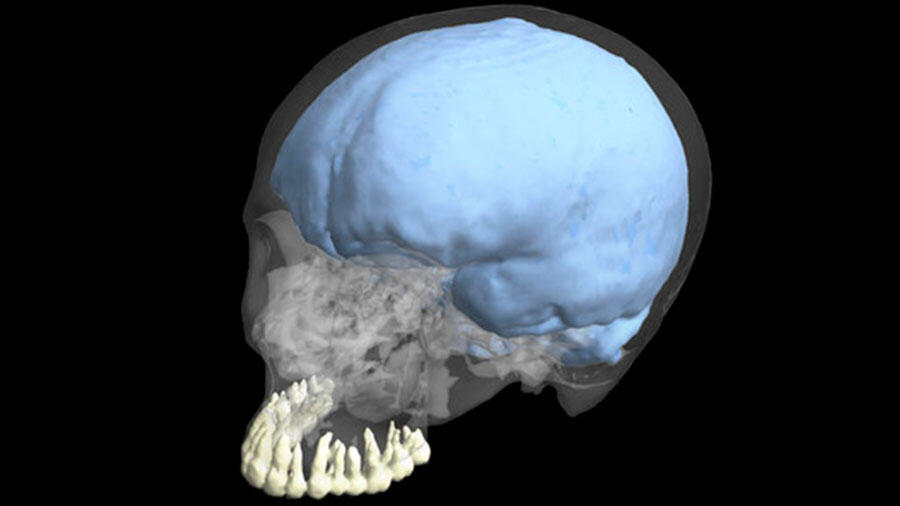 La evolución de los dientes y del cerebro no fueron de la mano