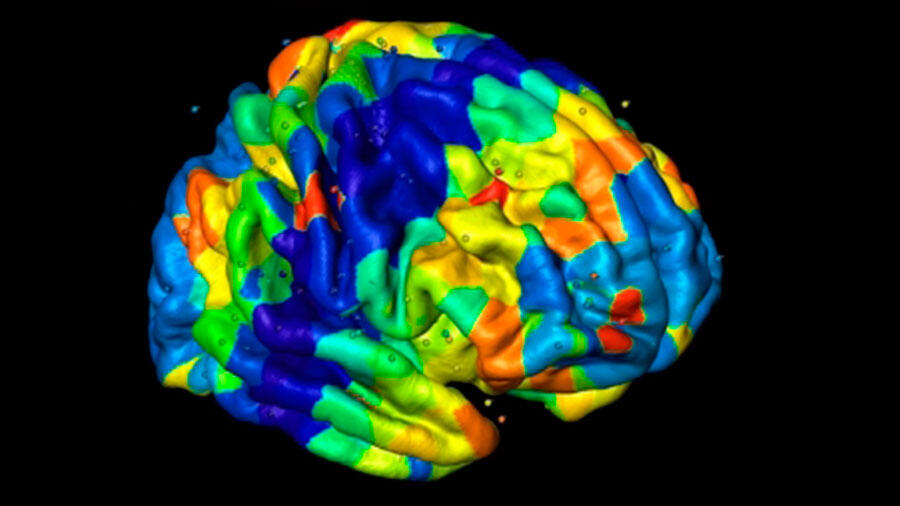 Esta proteína que puede ser clave en el tratamiento de trastornos neurodegenerativos