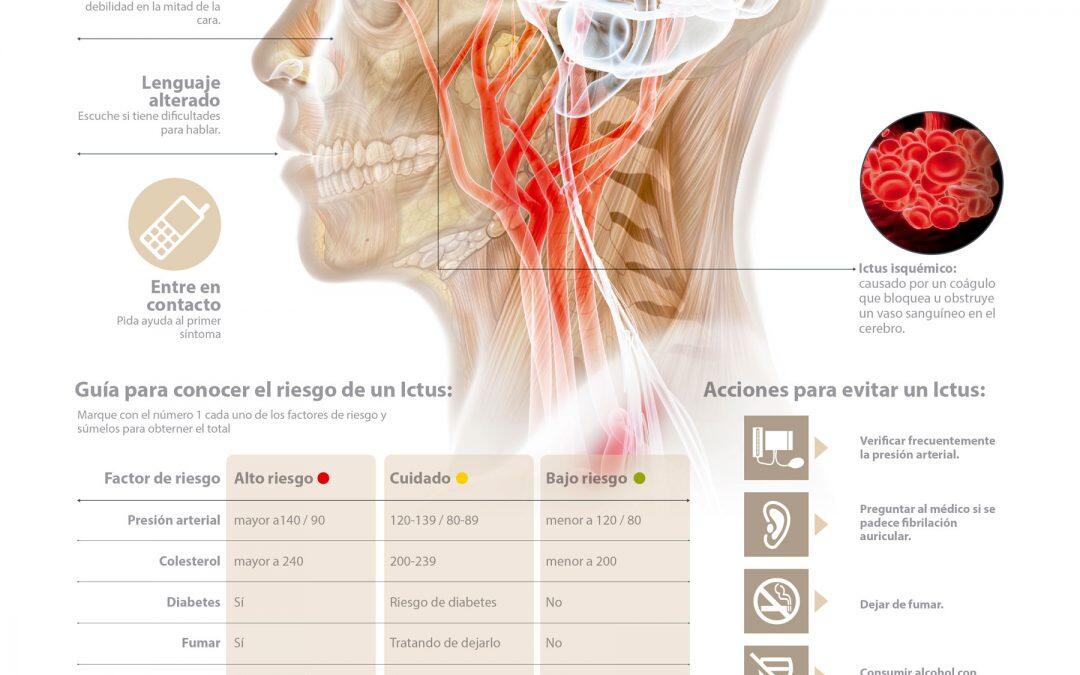 ¿Cómo prevenir un Ictus?