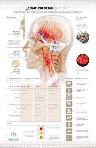 09-01-17-como-prevenir-un-ictus