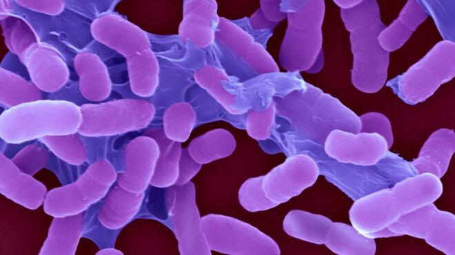 World’s most threatening superbugs ranked in new list