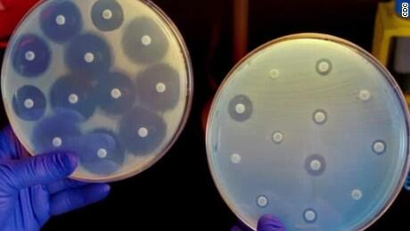 CNN Image of How Antibiotic Resistance is Seen in Labs