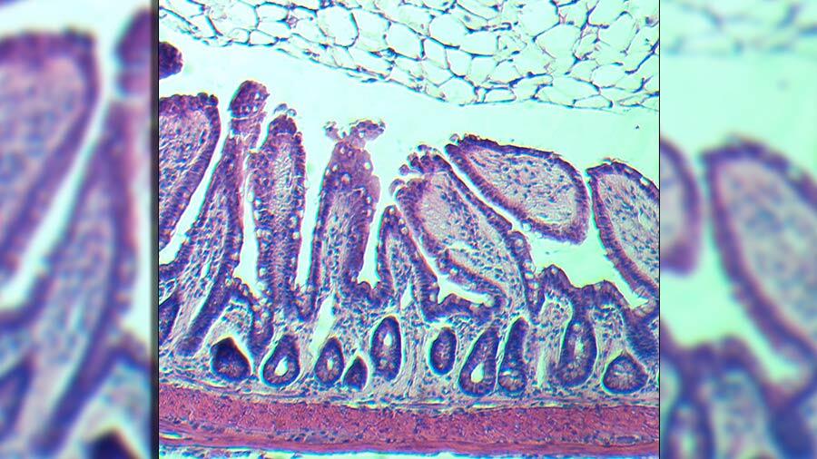 Consiguen revertir el envejecimiento de células madre de intestino