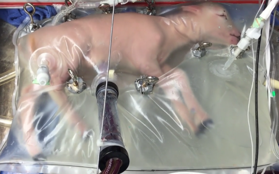 New artificial womb technology could keep babies born prematurely alive and healthy