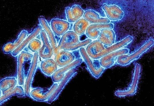 ¿A la vista un posible tratamiento eficaz contra la infección por virus de Marburgo?