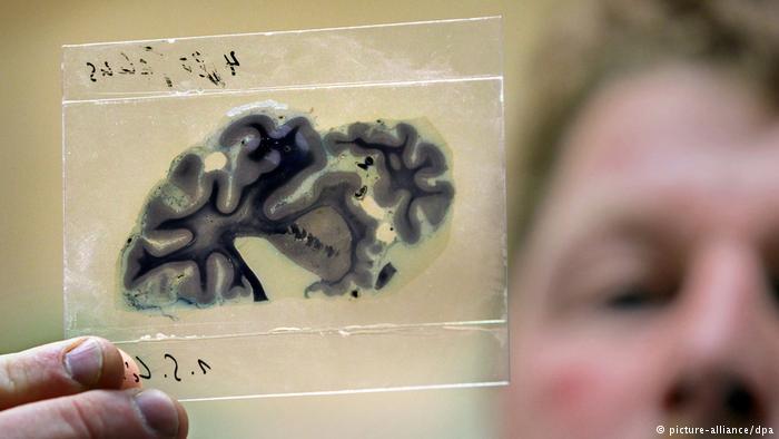 German research organization to identify Nazi victims that ended up as brain slides