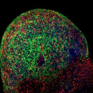 Un modelo celular para ayudar a estudiar la relación entre enfermedades neurodegenerativas