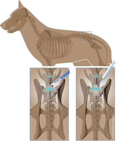 Terapia con células madre para regeneración de discos intervertebrales