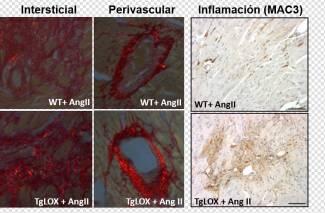 La enzima lisil oxidasa altera la función diastólica y contribuye a la hipertrofia cardíaca