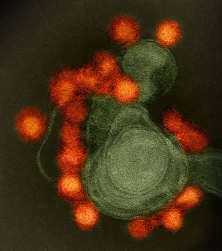 ¿Usar virus del Zika para matar selectivamente ciertas células cancerosas?