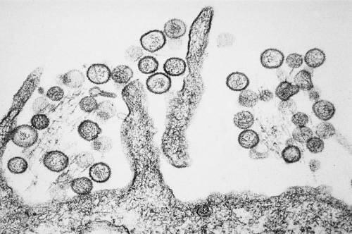 Factores genéticos pueden determinar la gravedad de la infección por hantavirus