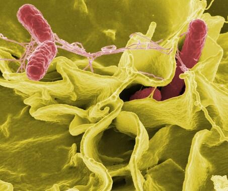 La salmonela causó una de las epidemias más devastadoras del siglo XVI en México