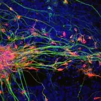 La proteína RAC1 podría ser una nueva diana terapéutica para combatir la degeneración neuronal en el párkinson