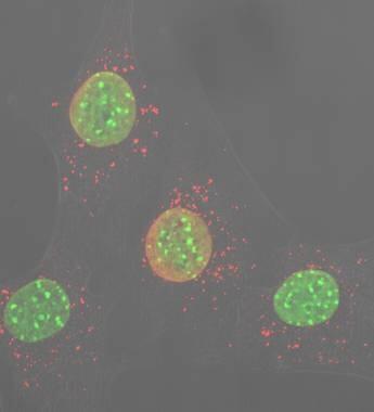 La falta de una única proteína mitocondrial genera inflamación severa