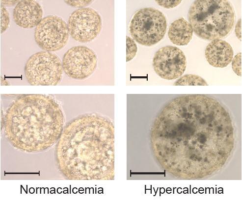 Un tatuaje biodiseñado detecta los niveles de calcio en la sangre