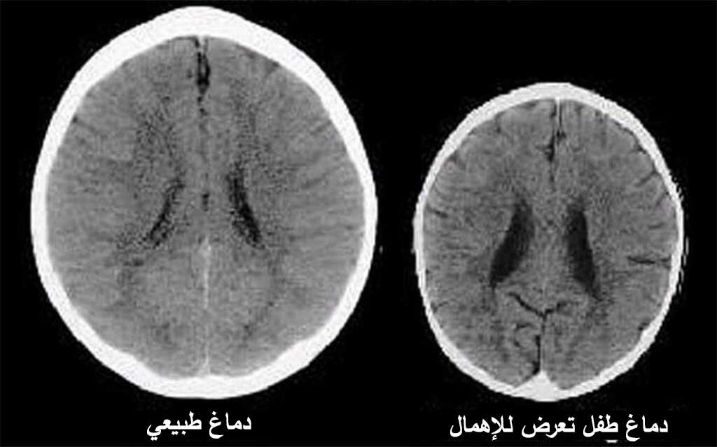 دراسة علمية تكشف تأثير تربية الأم على دماغ أطفالها..