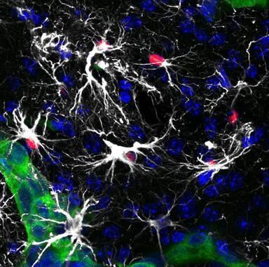 Una nueva terapia alarga la vida de pacientes con metástasis cerebral