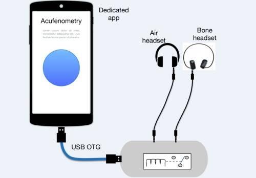 Un dispositivo permitirá que los pacientes de tinnitus controlen su evolución desde casa