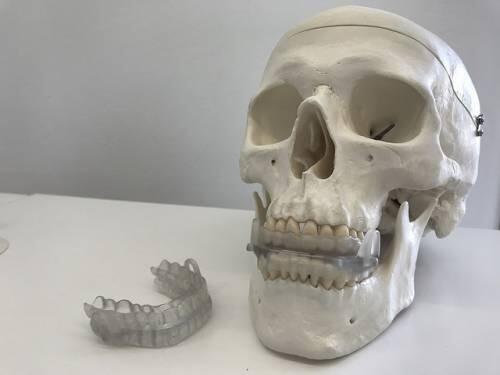 Dispositivo bucal que previene la apnea del sueño fabricado a medida con impresora 3d