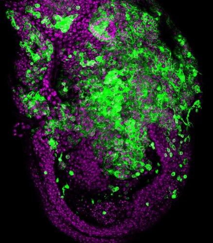 Un estudio con Drosophila ayuda a comprender el comportamiento metastásico de los tumores humanos