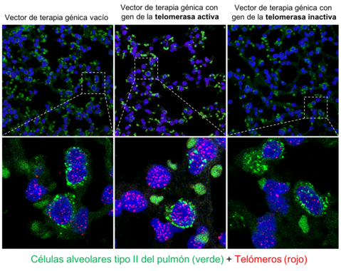 Logran con terapia génica regenerar neuronas pérdidas en accidentes cerebro vasculares