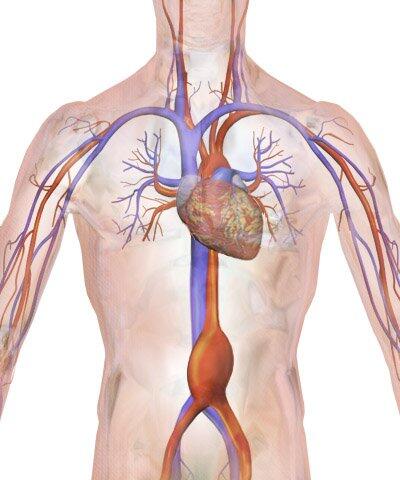 Las lipoproteínas que transportan colesterol ‘bueno’ pierden su capacidad cardioprotectora con aneurisma aórtico abdominal