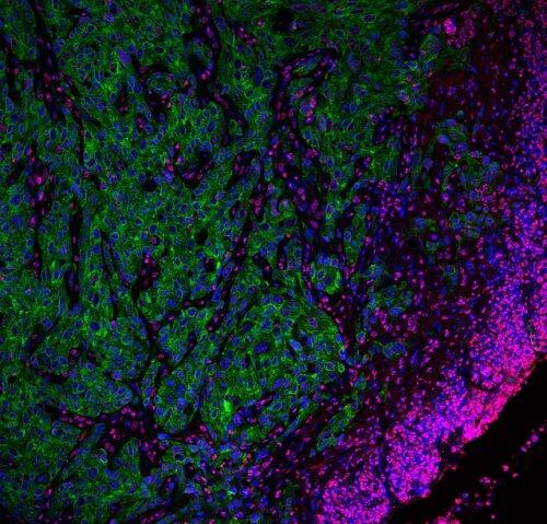 Las terapias epigenéticas podrían originar la aparición de tumores agresivos