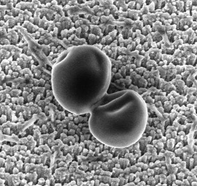 Nanoestructuras para proteger los implantes de las infecciones