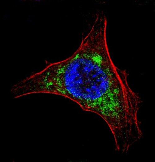 Científicos del CSIC desarrollan nuevas vacunas contra la hepatitis C