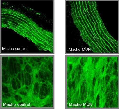 Una nutrición insuficiente en la etapa fetal predispone el desarrollo de enfermedades cardiovasculares