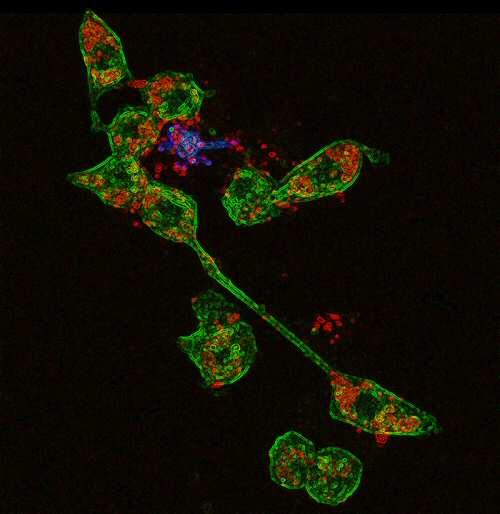 Descubren mecanismo clave de células protectoras del cerebro