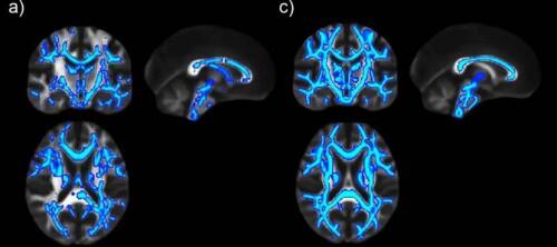 Diseñan sustancias capaces de aumentar la memoria en el cerebro