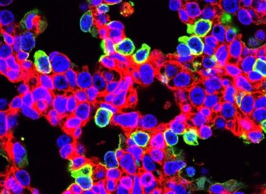 Nueva terapia con CRISPR para ‘curar’ una enfermedad pulmonar mortal en ratones