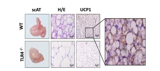 Un fármaco que se aplica en el control del colesterol posee acción contra la caquexia asociada al cáncer